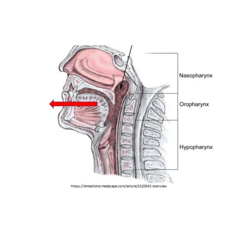 Moving jaw forward